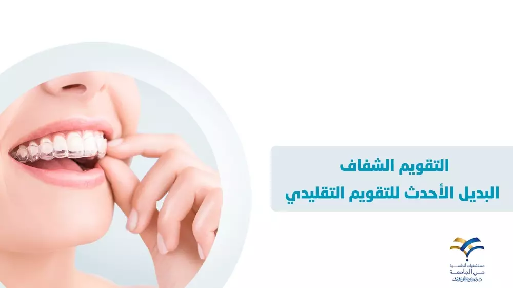 التقويم الشفاف