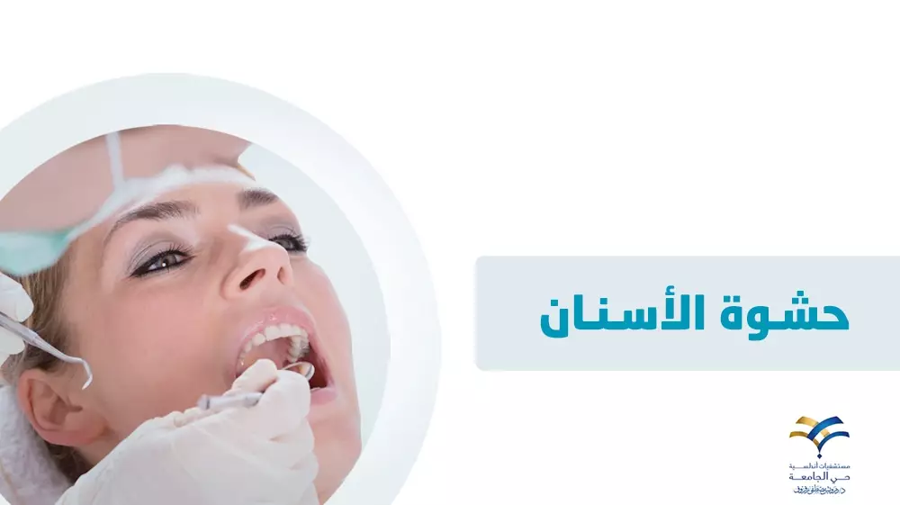 حشوة الأسنان