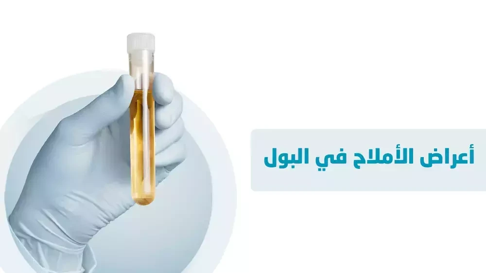 أعراض الأملاح