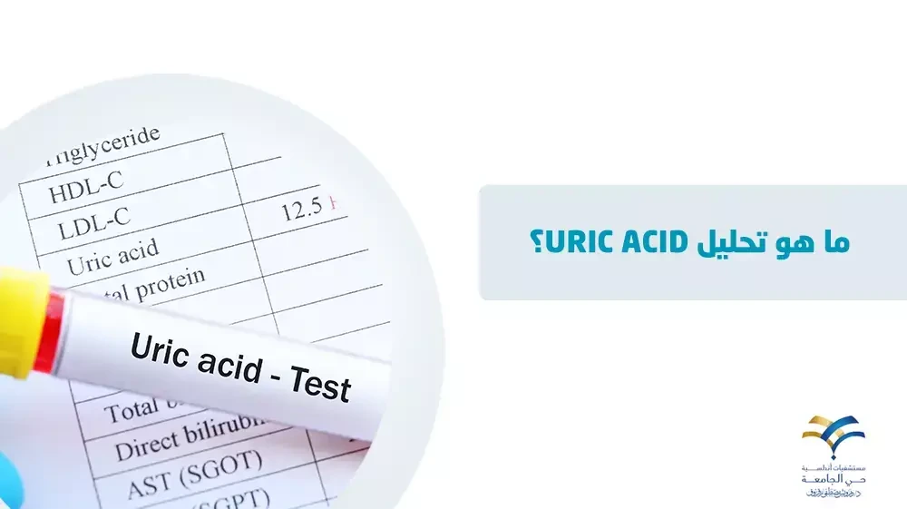 تحليل uric acid